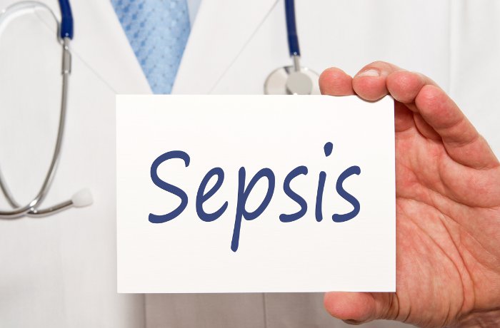 Sepsis Management