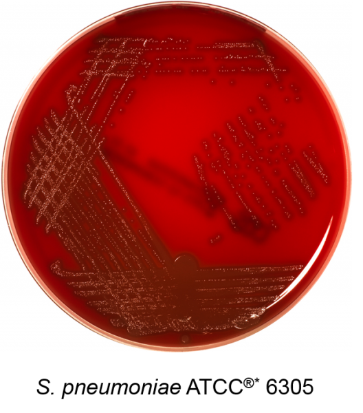 Columbia Agar + 5% Sheep Blood